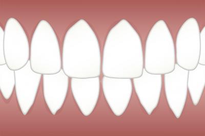 implant dentaire strasbourg